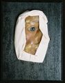 Moulage, Keine Diagnose (rechte Gesichtshälfte/Auge), 18,5x23,8x5 cm