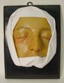Moulage, Herpes facialis (Gesicht), 17,5x23,5x7 cm