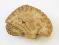 Moulage, (wahrscheinlich) Stauungsblutungen im Gehirn, 19x30x7 cm
